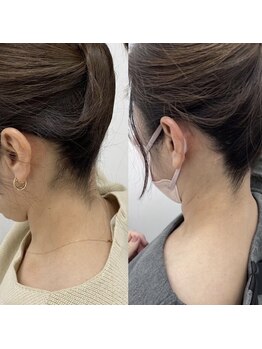 ミース 鹿児島店/『うなじ矯正』でうなじ美人に
