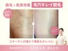 【迷ったらこれ★】夏本番に間に合う！毛穴キレイ３箇所脱毛体験￥0