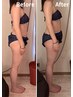 【全身集中痩身】セルライトゼロ2全身 60分 ¥13,000