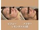 アオイスター(AOIstar)の写真