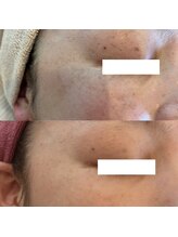 アンク(Ankh)/デリケートな目の周りも◎