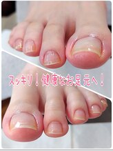 ノーブルフルール(Noble fleur)/健康に導く丁寧フットネイルケア