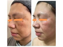 シャンティ 佐倉店(Shanti)/お客様の成果☆ （4）