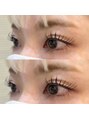 アイモイ(eye moy)&nbsp;ラッシュアディクトでまつ毛を一緒に伸ばしましょう！