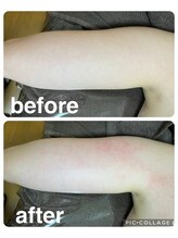 ギンザアール(GINZA R.)/二の腕引き締め！