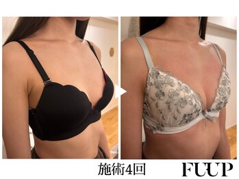 フーアップ 北千住(FU-UP)/バストアップ/育乳（4回）