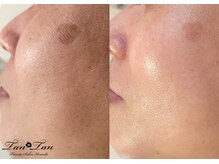 プライベートサロン タンタン(tantan)/基礎からキレイに