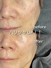 リイル バイ クレビア(REILE by Crebia)/お客様写真