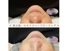 ルフレの雰囲気（美白、シミ、シワ、たるみ、ニキビ改善♪肌本来の美しさへ♪）