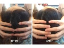 りもあず(ReMore-S)/頭の形も変わる！