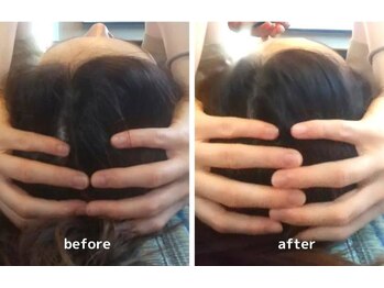 りもあず(ReMore-S)/頭の形も変わる！