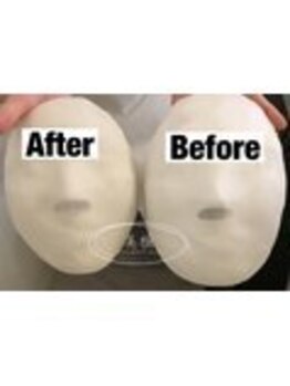 美極 銀座店/銀座/小顔コルギ/小顔矯正