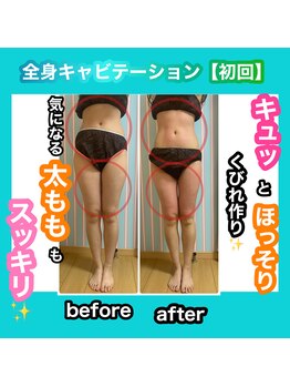 ビューティ ウィッチ(Beauty Witch)/なかなか痩せない部分もお任せ♪