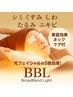 今だけ!60%OFF【小顔美人】首からお顔全体ひき上げ&美肌BBL光フェイシャル