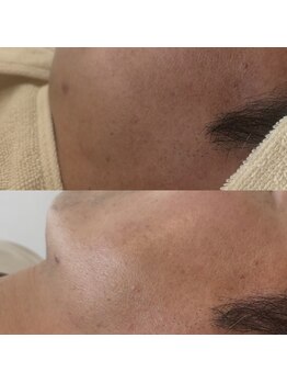オニュ(onyu)/浮腫激減！たった20分の施術で