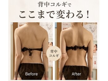 コルギサロン ヴィサンテ(Visante)の写真/憧れの小顔と自信へ♪新技術導入背中コルギで、おば見え背中改善！あなた史上最高の私へ◎