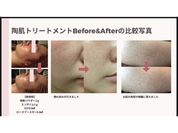 サロンドール(SalonDoll)/結果が出る！