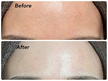 サロン デ ココフラン(Salon de CocoFran)/REVI陶肌トリートメント