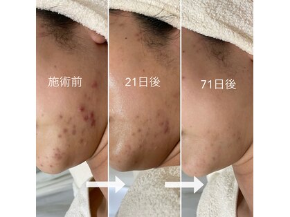 シェノンの写真