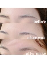 アイル(I’LL)/メイクが楽になるワックス脱毛