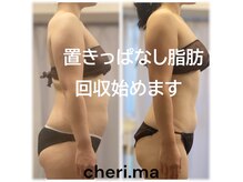 シェリマ 西新宿(cheri.ma)