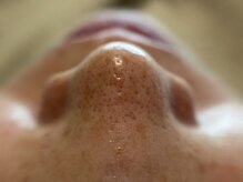 リセットプラス(Reset+)/