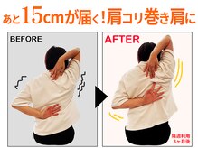 ストレチックス 東日本橋edone店/【実例：手組】隔週3ヵ月の変化