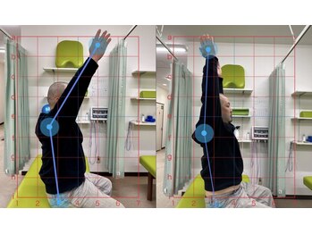 整骨院こころ 祇園院/可動域の変化