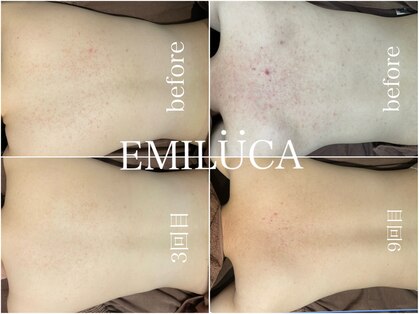 エミルカ 北谷店(EMILUCA)の写真
