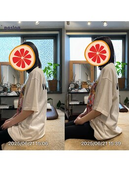 グレフル鍼灸接骨院 整体院 心斎橋/整体/肩こり/マッサージ/腰痛