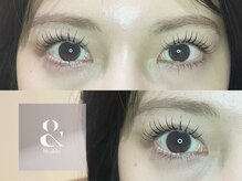 グランウィーユ バイ ロンド 銀座(Grand oeil by Lond)/【mizuki】アンドヘルシー100本