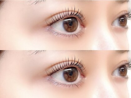 リングス(Riings)の写真