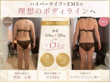 エステサロン ルックス ビューティー(エステサロン Looks Beauty)