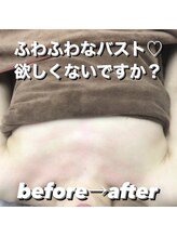 レリール バイ エレクトロ(Rerire by electro)/ふわふん美乳◎バストアップ