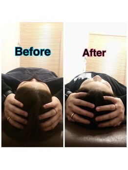 スカイ 鍼灸整骨院 整体院(SKY)/小顔矯正