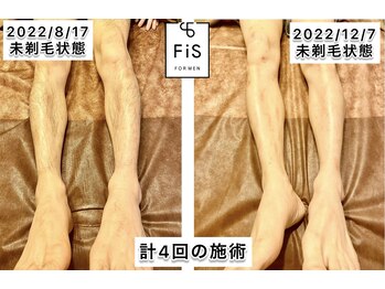 フィズ 大和店(FIS)/☆メンズの足の脱毛も☆