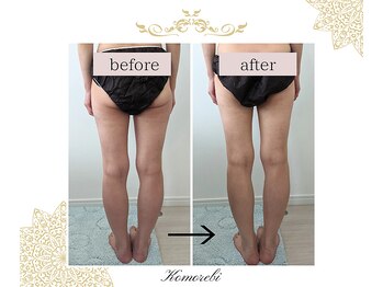 コモレビ(Komorebi)/