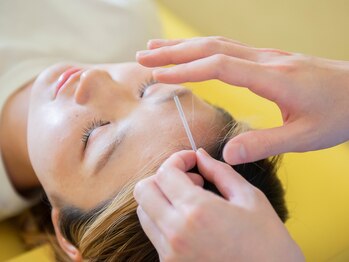 ゆめたか接骨院 鍼灸院 整体院 大沢野院/内側から再生を促す美容鍼施術◎