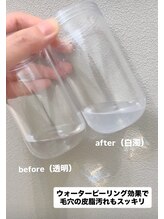 フェリノ(FERINO)/毛穴洗浄の効果