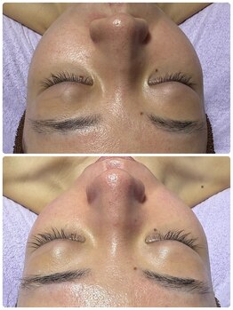 アンヴィオ ギンザ(Anvio Ginza)/フェイシャルワックス