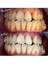 エクリュ(Ecru)/Before→After