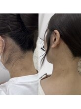 ミース 鹿児島店/『うなじ矯正』でうなじ美人に