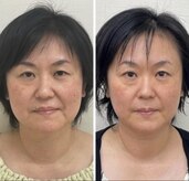 エステシオン(ESTESiON)