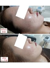 ミュー(Mieux)/綺麗になっていつも楽しいです！