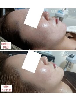 ミュー(Mieux)/綺麗になっていつも楽しいです！