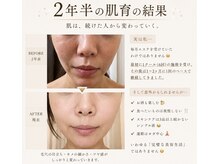 クレビア(Crebia)の雰囲気(バイオセルショット65%エステ&水光肌ボツリヌスエステの育肌)