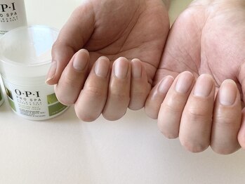 ネイルズエー(nailsA)の写真/ネイルのベースとなるケアで潤った上品な手元へ。スッキリした爪先が叶う♪