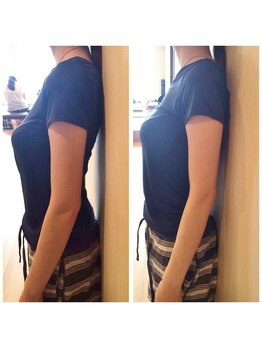 骨盤ストレッチ整体 b/姿勢（猫背）矯正★変化写真