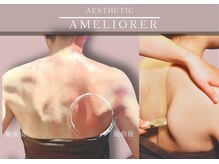 アメリオレ 三鷹店(AMELIORER)/牛角カッサ裏メニュー☆