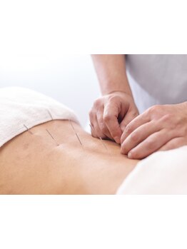 鍼灸施術を受けたい